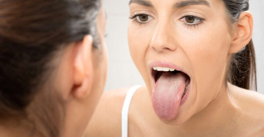 lengua-dolor