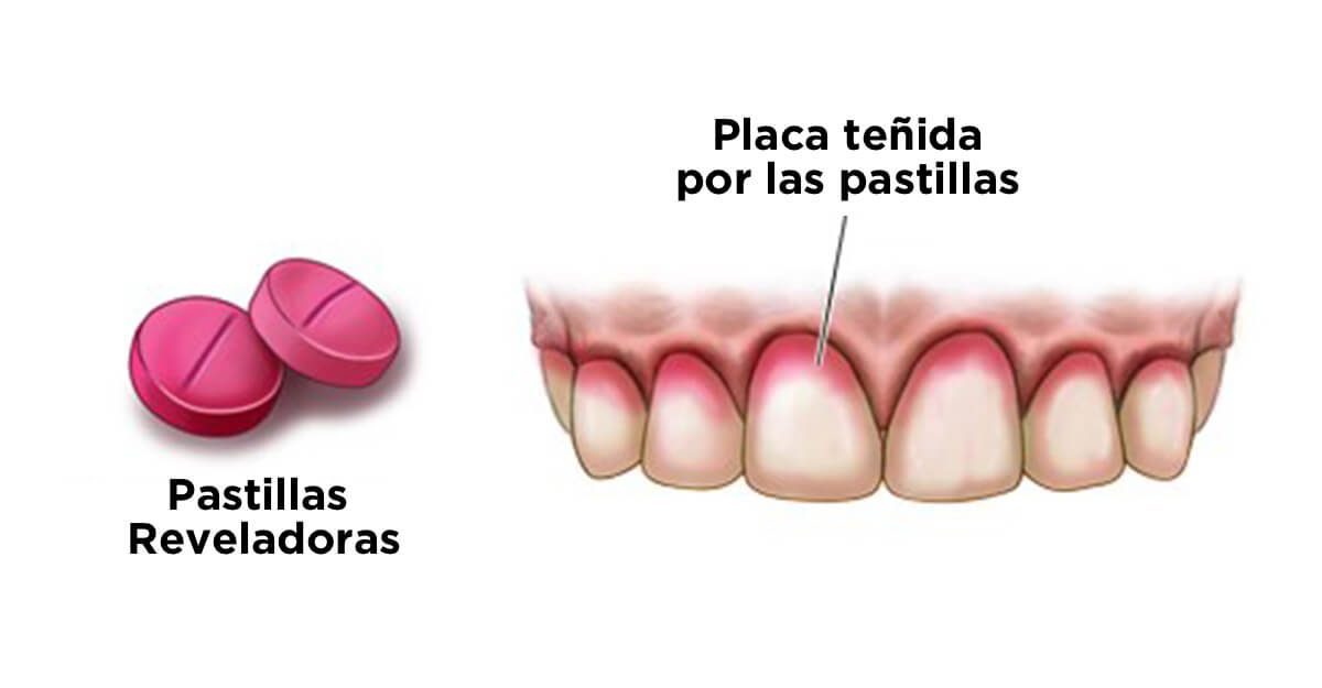 pastillas