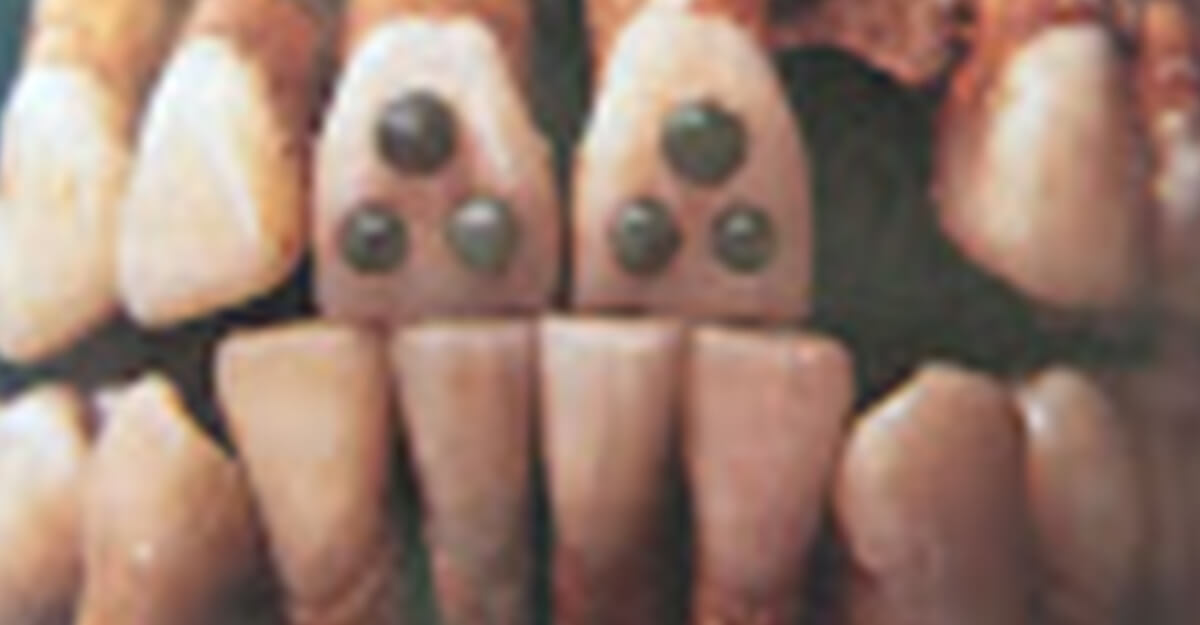 dentales-mayas